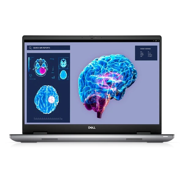 Dell Dell Precision 7680-XFYNN, Notebook – Bild 2