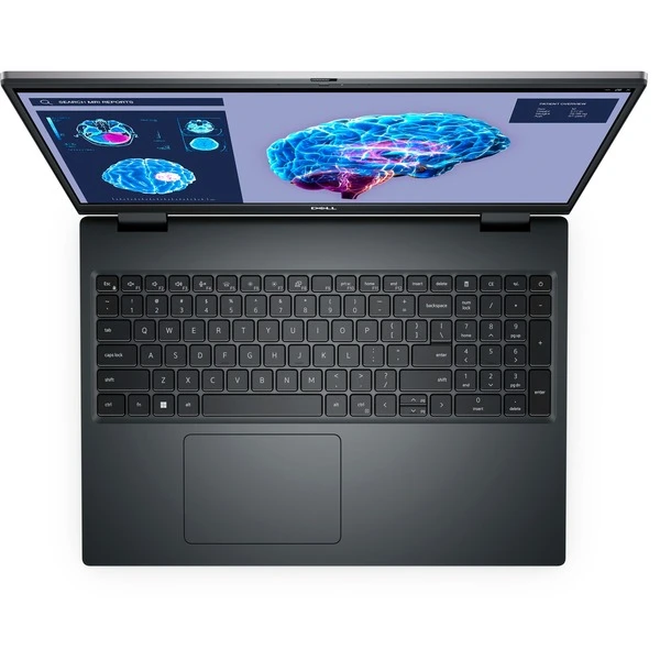Dell Dell Precision 7680-XFYNN, Notebook – Bild 4